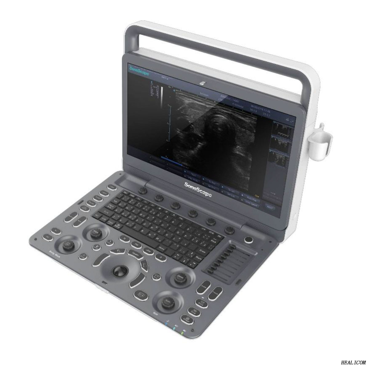 SonoScape E2 Professional Hospital utilizza un sistema completo di diagnosi della macchina ad ultrasuoni Digital Color Doppler