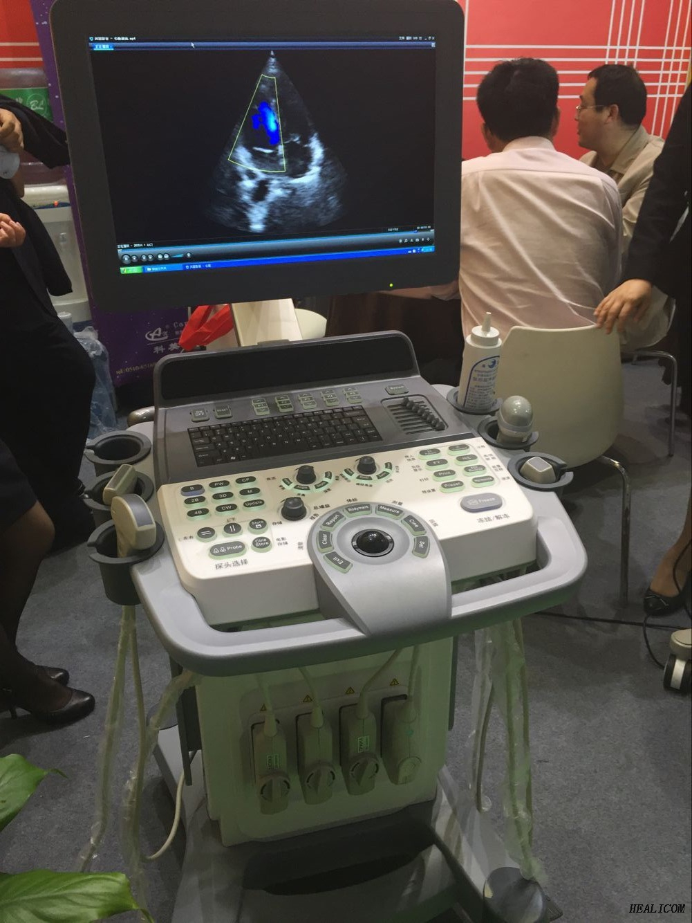 Top usg medical digital picture therapy 4D Huc-800 Ultrasound Machine su salute e medicina