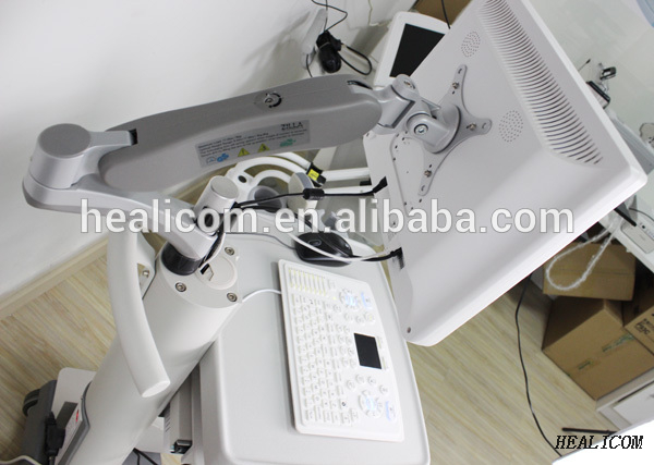 HBW-100 Sistema diagnostico ad ultrasuoni Scanner digitale 3D 4D B/N per macchina ad ultrasuoni
